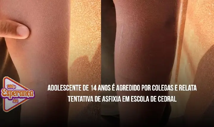Adolescente de 14 anos é agredido por colegas e relata tentativa de asfixia em escola de Cedral