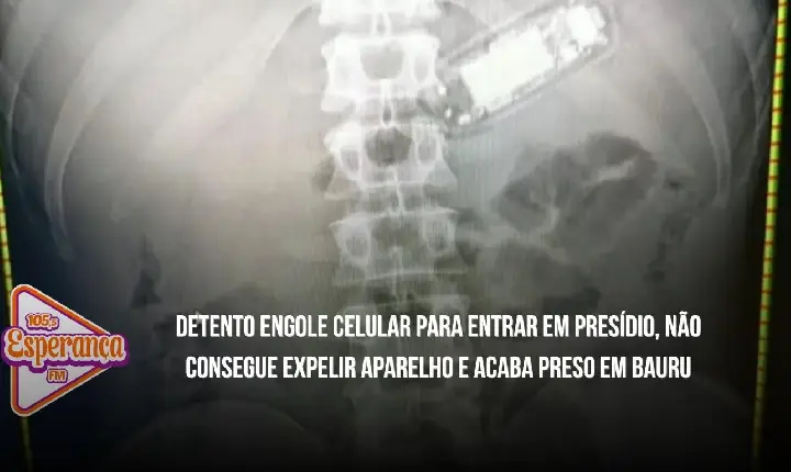 Detento engole celular para entrar em presídio, não consegue expelir aparelho e acaba preso em Bauru
