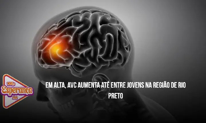 Em alta, AVC aumenta até entre jovens na região de Rio Preto