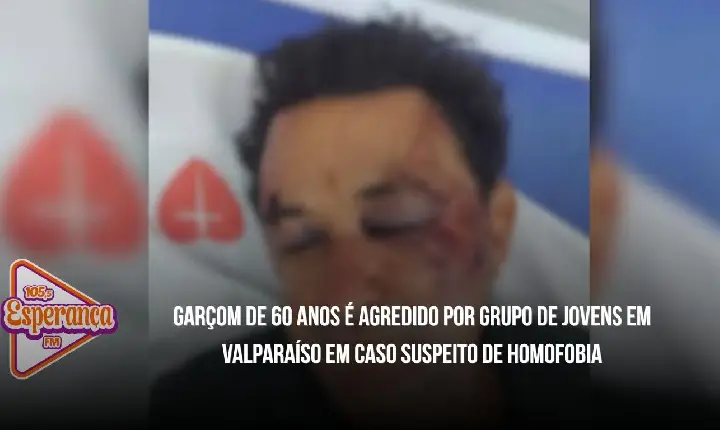 Garçom de 60 anos é agredido por grupo de jovens em Valparaíso em caso suspeito de homofobia