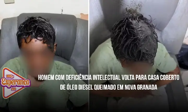 Homem com deficiência intelectual volta para casa coberto de óleo diesel queimado em Nova Granada