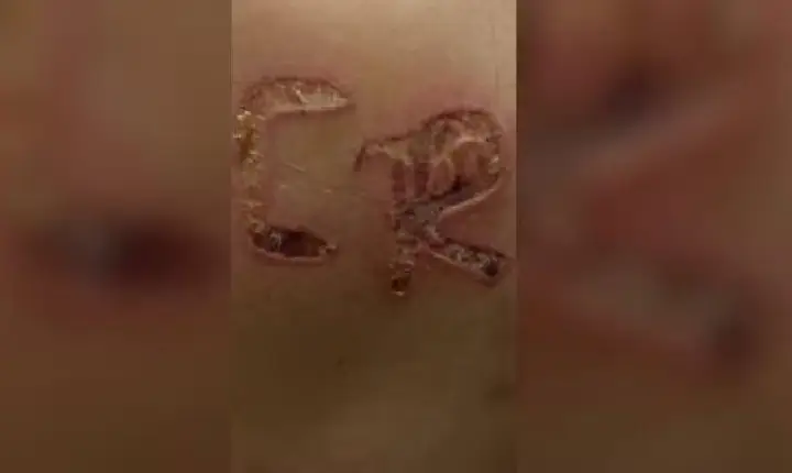 Marido é preso após marcar iniciais do nome dele no corpo da esposa