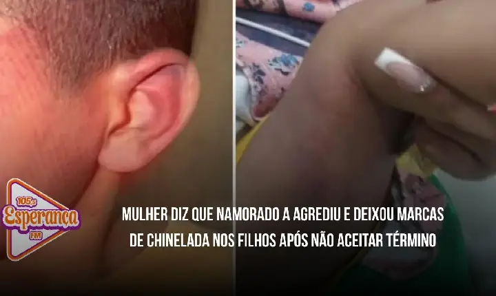 Mulher diz que namorado a agrediu e deixou marcas de chinelada nos filhos após não aceitar término