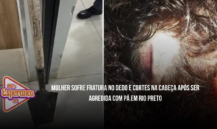 Mulher sofre fratura no dedo e cortes na cabeça após ser agredida com pá em Rio Preto