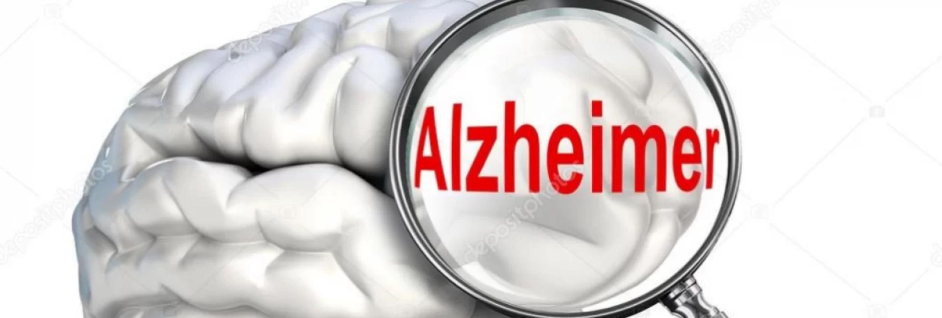 Cientistas desenvolvem exame capaz de detectar o Alzheimer 3,5 anos antes do diagnóstico clínico.
