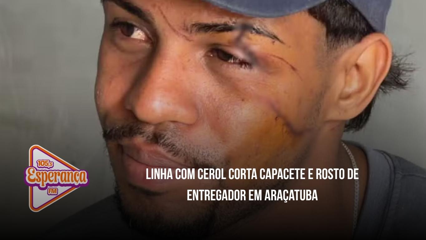 Linha com cerol corta capacete e rosto de entregador em Araçatuba