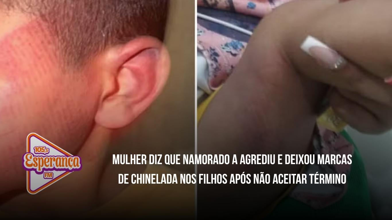 Mulher diz que namorado a agrediu e deixou marcas de chinelada nos filhos após não aceitar término