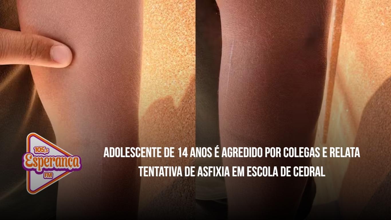 Adolescente de 14 anos é agredido por colegas e relata tentativa de asfixia em escola de Cedral