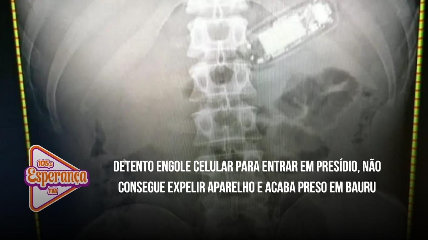 Detento engole celular para entrar em presídio, não consegue expelir aparelho e acaba preso em Bauru