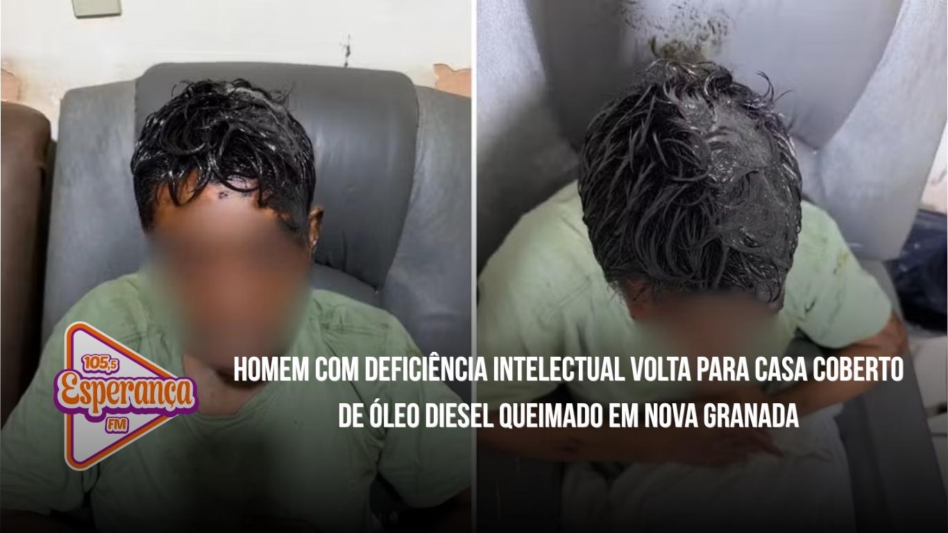 Homem com deficiência intelectual volta para casa coberto de óleo diesel queimado em Nova Granada